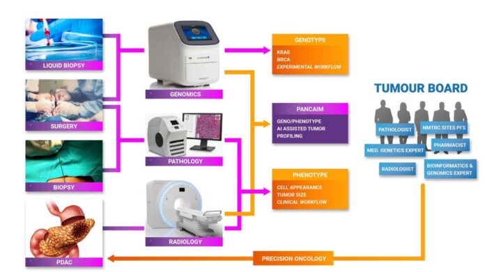 AI-analyse moet pancreaskanker beter behandelbaar maken