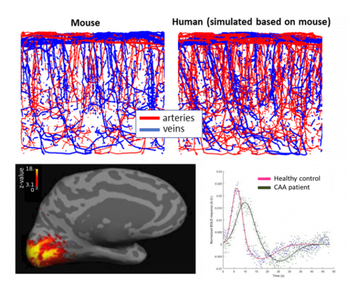 cerebrovasculaire functies, afbeelding beeldvorming