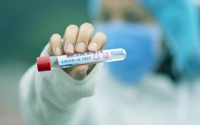 PCR-test-covid-Pixabay