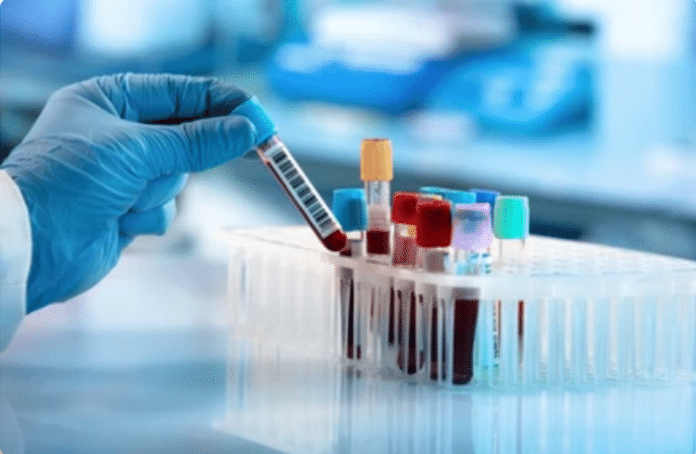 bloedanalyse - hand laborant bij rekje met bloedbuisjes